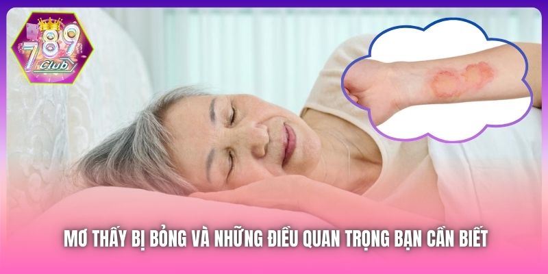Mơ Thấy Bị Bỏng Và Những Điều Quan Trọng Bạn Cần Biết